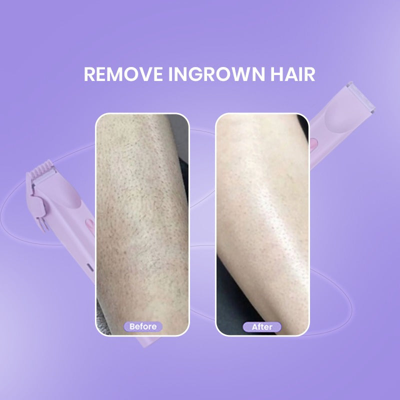 2 in 1 Women Beauty Shaver - Easy Hair Removal, Best Self-Care Gift
