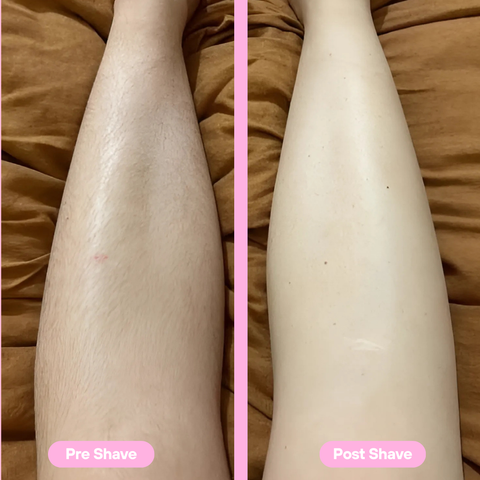 Kemie 5-in-1 Beauty Shaver - Easy Hair Removal, Best Self-Care Gift