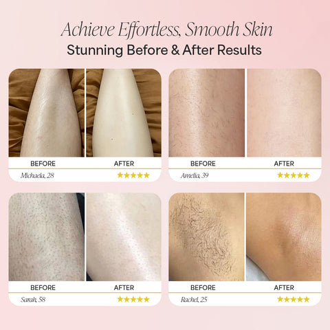 Kemie 5-in-1 Beauty Shaver - Easy Hair Removal, Best Self-Care Gift
